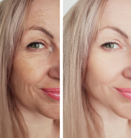 Antes e depois corporal