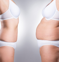 Antes e depois facial